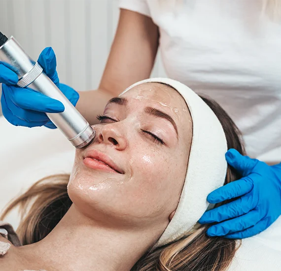 Fractional CO2 Facial05