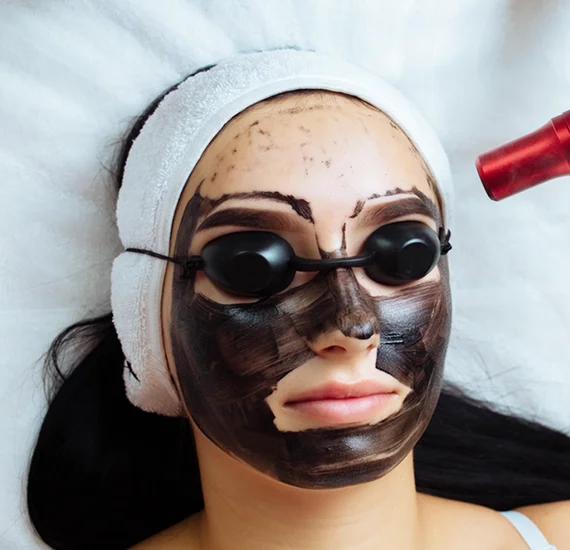 Hollywood charcoal facial05