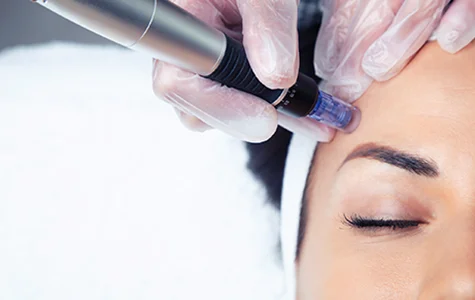 Laser Facials02