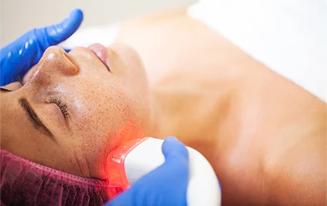 Laser Facials03