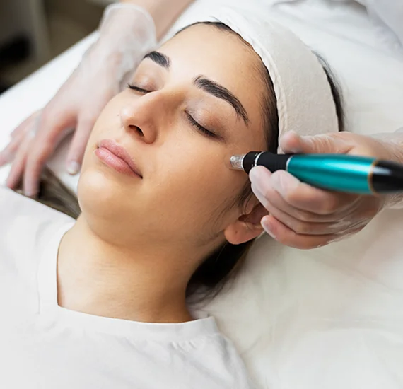 Micro Needling05