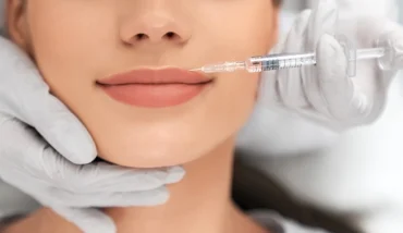 Discover how lip fillers enhance shape, smooth fine lines, and create natural-looking volume. Learn safety, results, and why they’re one of today’s most popular cosmetic treatments.