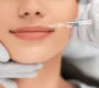 Benefits of Lip Fillers 90x80
