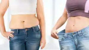 CoolSculpting vs Liposuction: Pros, Cons & Which Is Right for You