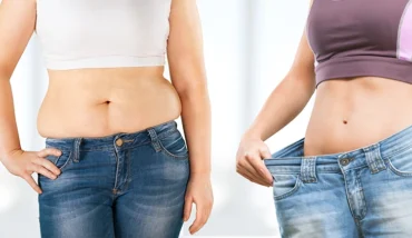 CoolSculpting vs Liposuction: Pros, Cons & Which Is Right for You