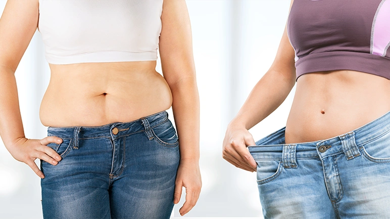 CoolSculpting vs Liposuction: Pros, Cons & Which Is Right for You