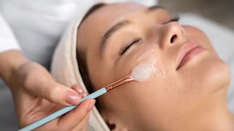 Chemical peel being applied to face for skin exfoliation and renewal