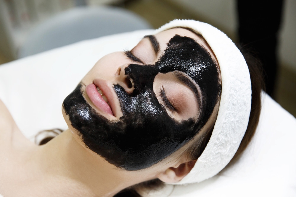 Carbon layer applied to face before laser treatment during Hollywood peel
