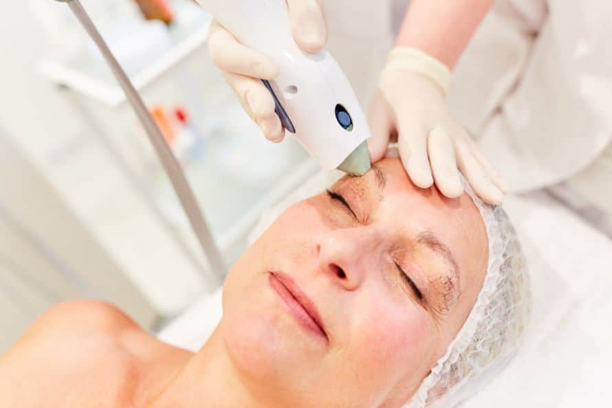 Anti-aging laser treatment on face at a medical aesthetic clinic