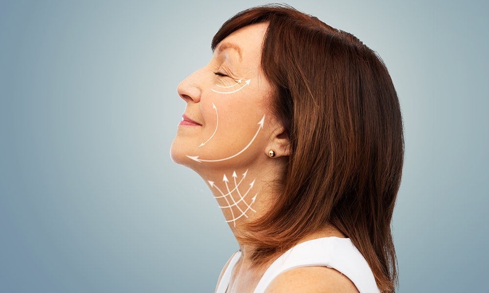 PDO thread lift vs surgical facelift comparison showing lifting results