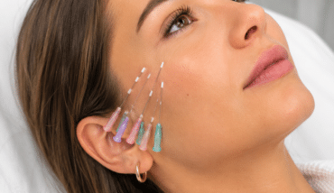 How Long Does a PDO Thread Lift Really Last?
