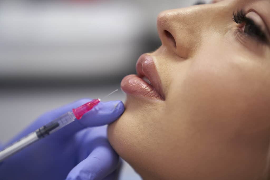 How Much Does Lip Filler Cost