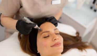 Can You Get Microneedling If You Have Rosacea
