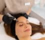 microneedling with rosacea 90x80