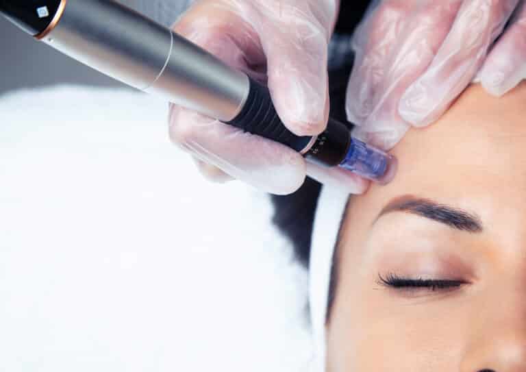 salmon sperm facial at eye candy medspa